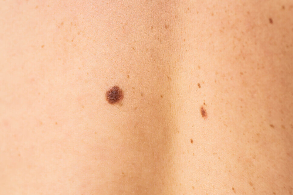 dsc04046-2025-03-08-09-23-13-utc-2-2